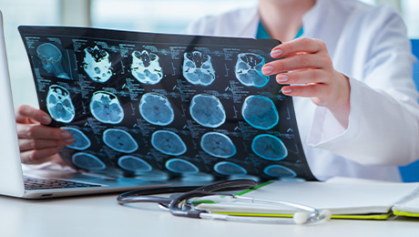 Hľadáme neurológa