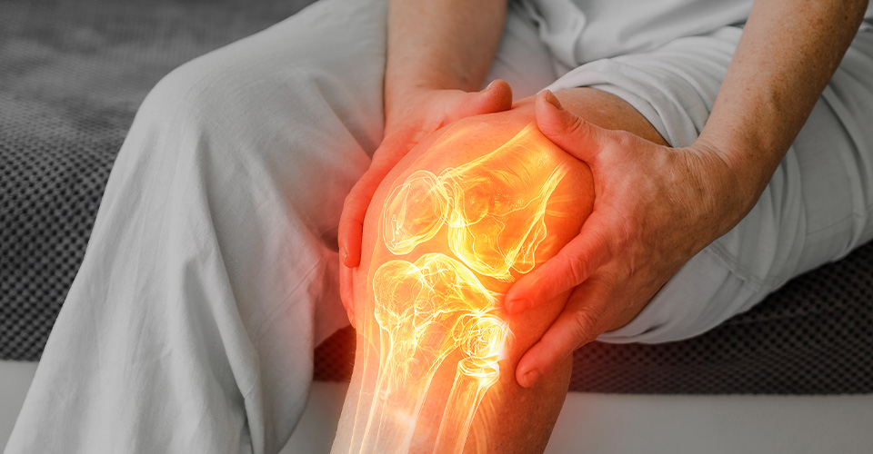 Kolenný kĺb a dolná končatina v praxi fyzioterapeuta