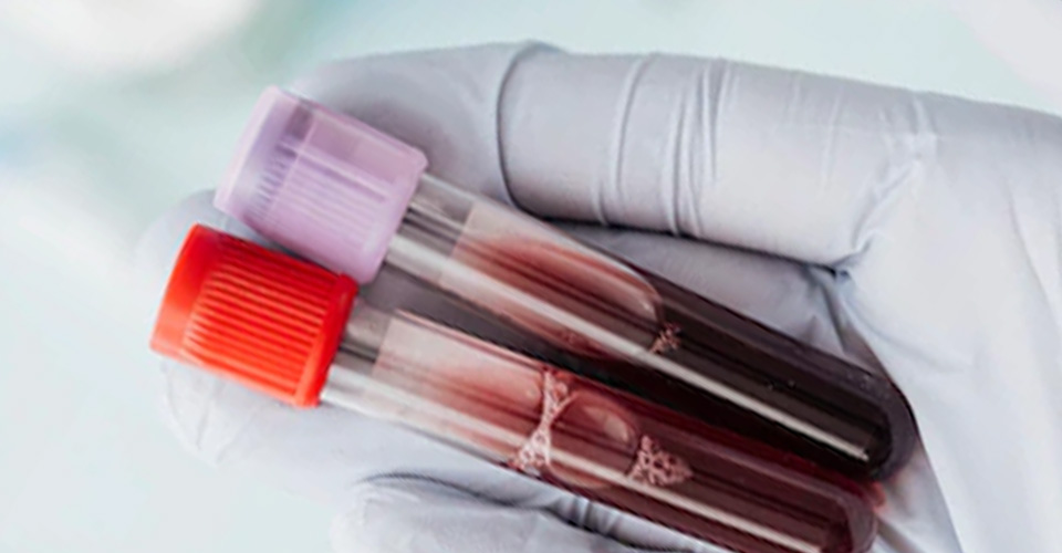 ODBERY KRVI VO FYZIO KLINIK