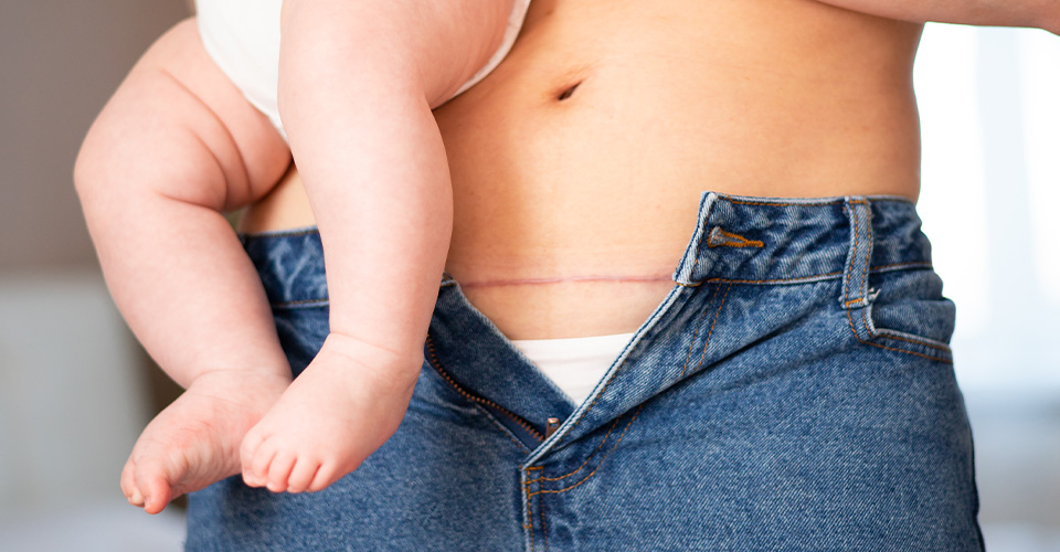 STAROSTLIVOSŤ O JAZVU PO CISÁRSKOM REZE